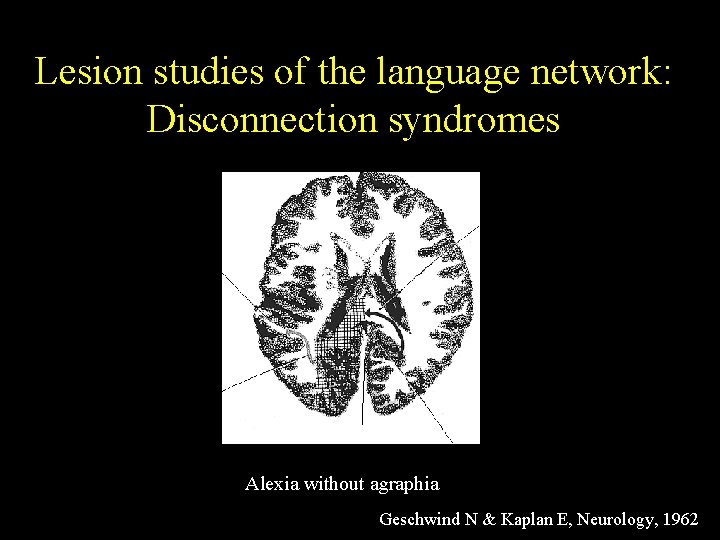 Lesion studies of the language network: Disconnection syndromes Alexia without agraphia Geschwind N &