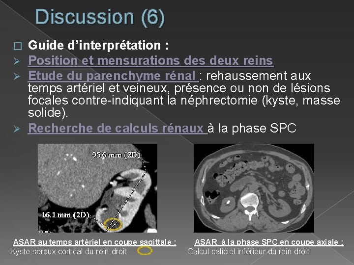 Discussion (6) Guide d’interprétation : Position et mensurations deux reins Etude du parenchyme rénal