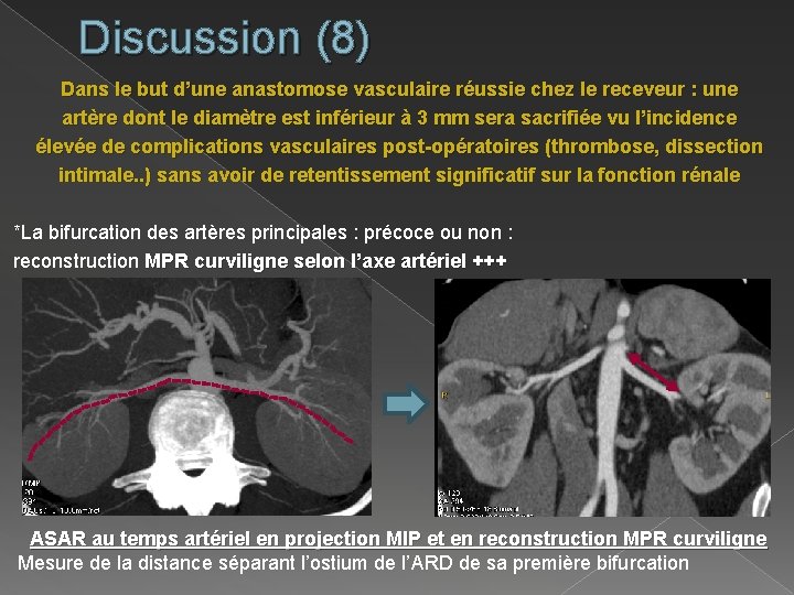 Discussion (8) Dans le but d’une anastomose vasculaire réussie chez le receveur : une