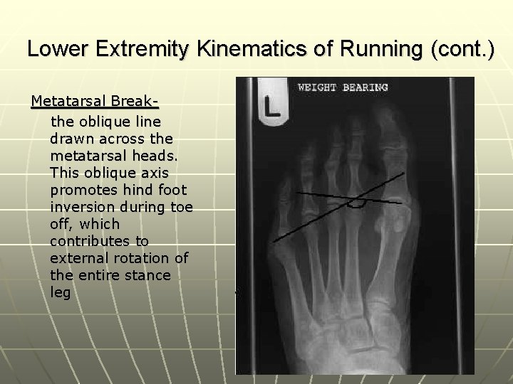 Lower Extremity Kinematics of Running (cont. ) Metatarsal Breakthe oblique line drawn across the