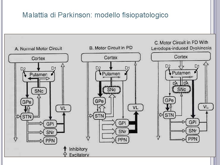 Malattia di Parkinson: modello fisiopatologico D 2 D 1 Malattia di Parkinson: modello fisiopatologico D 2 D 1