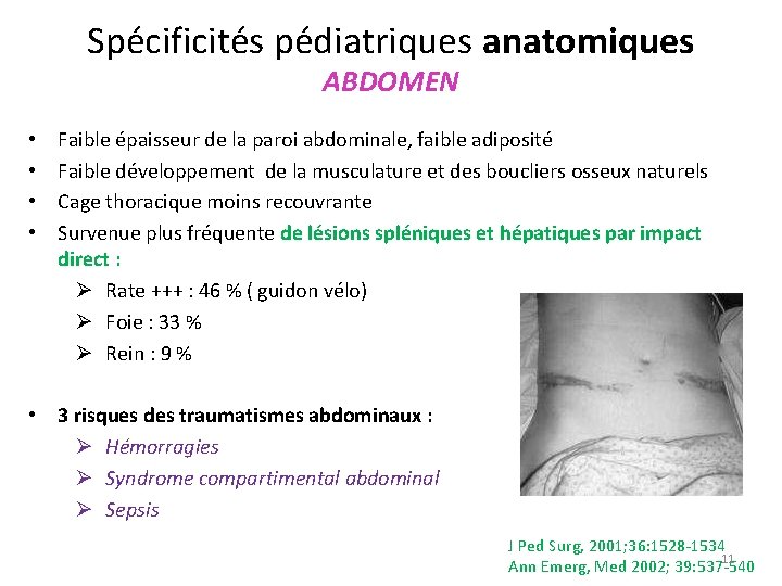 Spécificités pédiatriques anatomiques ABDOMEN • • Faible épaisseur de la paroi abdominale, faible adiposité