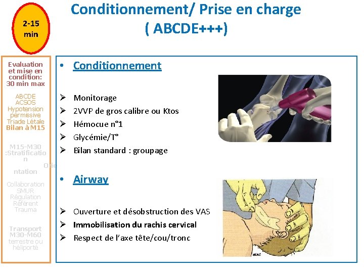 Conditionnement/ Prise en charge ( ABCDE+++) 2 -15 min Evaluation et mise en condition: