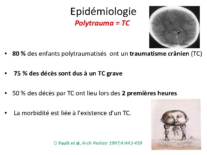  Epidémiologie Polytrauma = TC • 80 % des enfants polytraumatisés ont un traumatisme