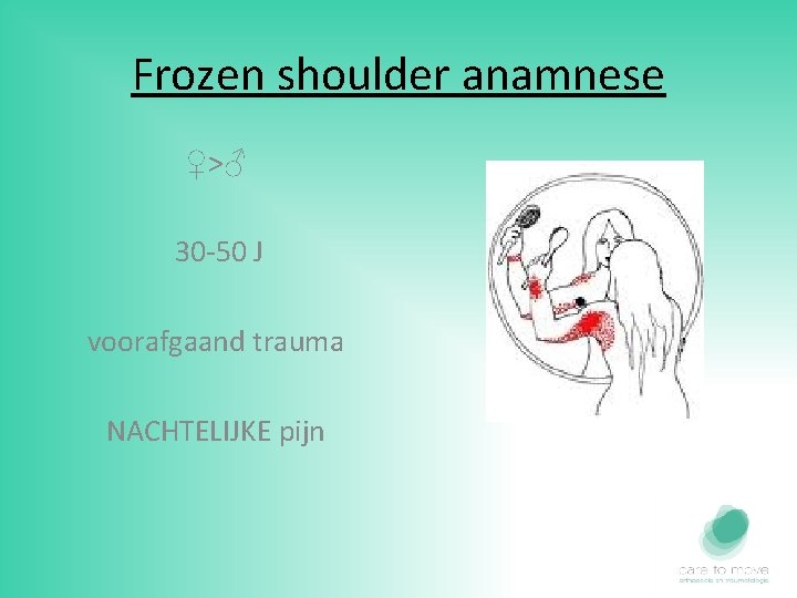 Frozen shoulder anamnese ♀>♂ 30 -50 J voorafgaand trauma NACHTELIJKE pijn 