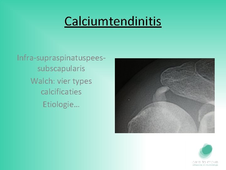 Calciumtendinitis Infra-supraspinatuspeessubscapularis Walch: vier types calcificaties Etiologie… 