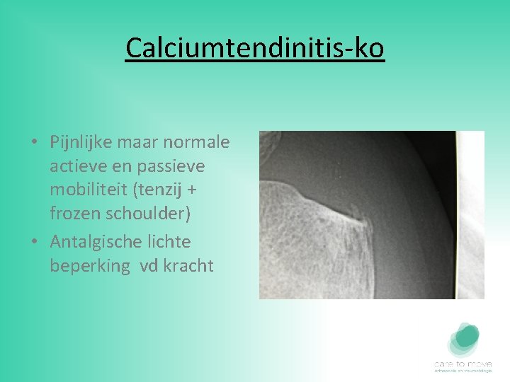 Calciumtendinitis-ko • Pijnlijke maar normale actieve en passieve mobiliteit (tenzij + frozen schoulder) •