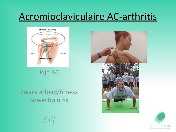 Acromioclaviculaire AC-arthritis Pijn AC Zware arbeid/fitness powertraining ♂>♀ 