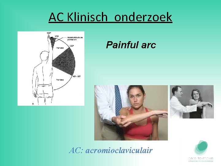 AC Klinisch onderzoek Painful arc AC: acromioclaviculair 