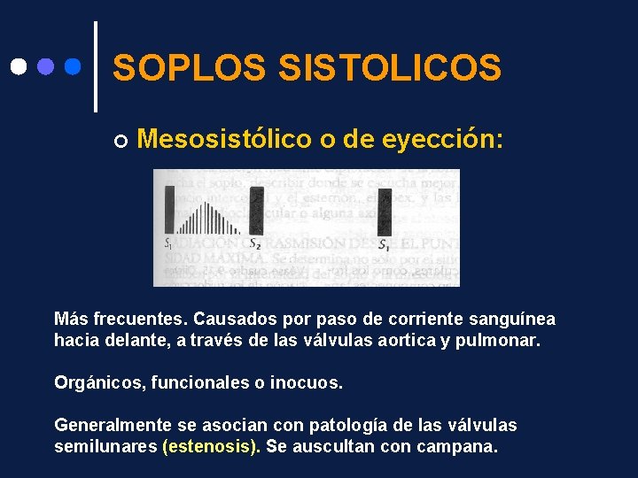 SOPLOS SISTOLICOS ¢ Mesosistólico o de eyección: Más frecuentes. Causados por paso de corriente