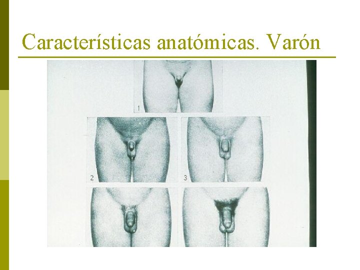 Características anatómicas. Varón 