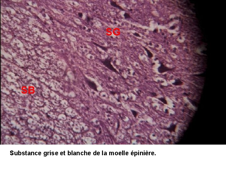 SG SB Substance grise et blanche de la moelle épinière. 