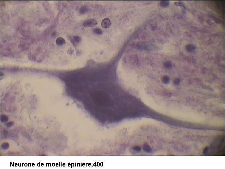 Neurone de moelle épinière, 400 