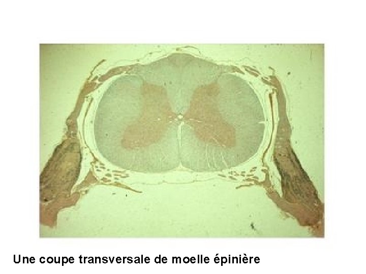 Une coupe transversale de moelle épinière 