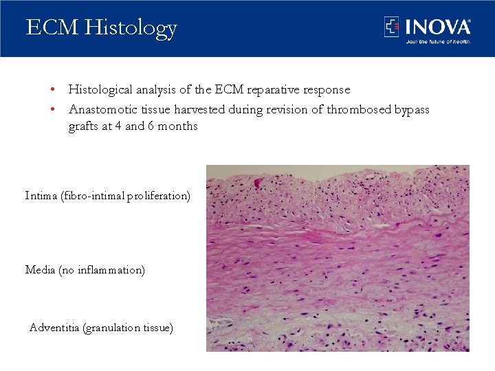 ECM Histology • Histological analysis of the ECM reparative response • Anastomotic tissue harvested