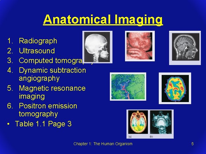 Anatomical Imaging 1. 2. 3. 4. Radiograph Ultrasound Computed tomography Dynamic subtraction angiography 5.
