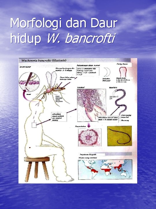 Morfologi dan Daur hidup W. bancrofti 