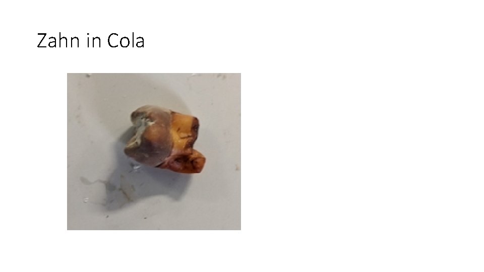 Zahn in Cola 
