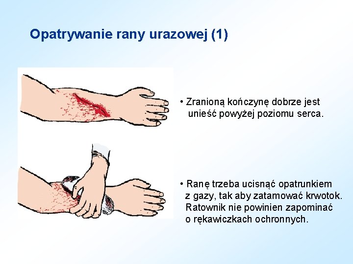 Opatrywanie rany urazowej (1) • Zranioną kończynę dobrze jest unieść powyżej poziomu serca. •