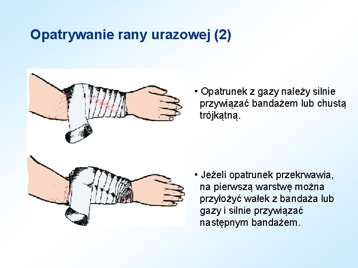 Opatrywanie rany urazowej (2) • Opatrunek z gazy należy silnie przywiązać bandażem lub chustą