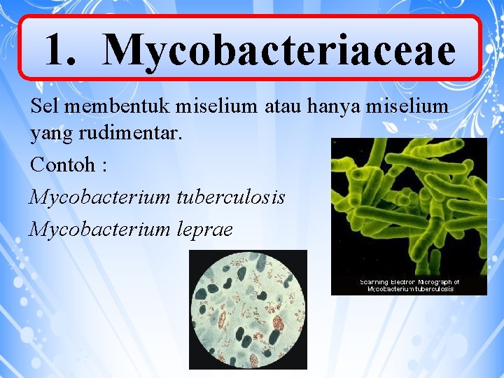1. Mycobacteriaceae Sel membentuk miselium atau hanya miselium yang rudimentar. Contoh : Mycobacterium tuberculosis
