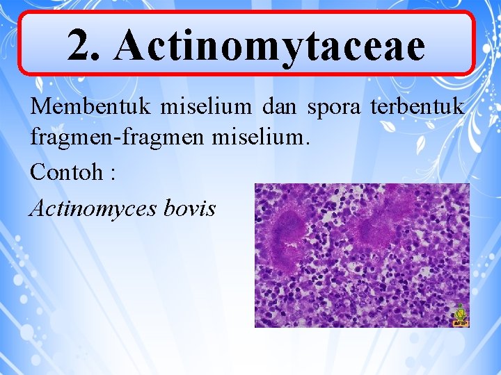 2. Actinomytaceae Membentuk miselium dan spora terbentuk fragmen-fragmen miselium. Contoh : Actinomyces bovis 