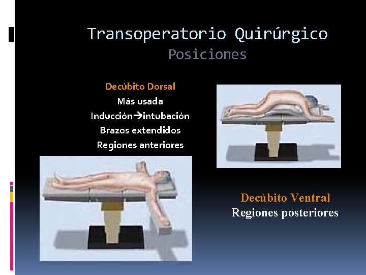 Transoperatorio Quirúrgico Posiciones Decúbito Dorsal Más usada Inducción intubación Brazos extendidos Regiones anteriores Decúbito