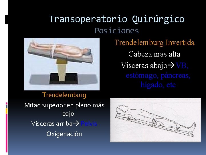 Transoperatorio Quirúrgico Posiciones Trendelemburg Invertida Cabeza más alta Vísceras abajo VB, estómago, páncreas, hígado,