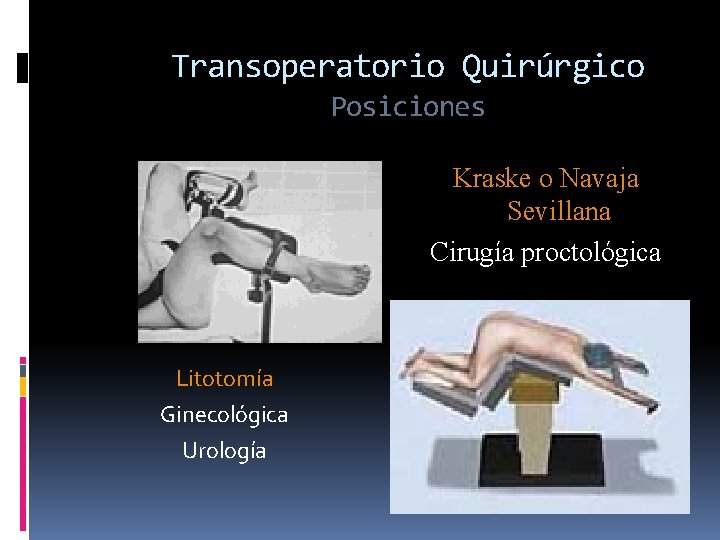 Transoperatorio Quirúrgico Posiciones Kraske o Navaja Sevillana Cirugía proctológica Litotomía Ginecológica Urología 