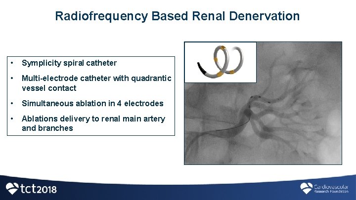 Radiofrequency Based Renal Denervation • Symplicity spiral catheter • Multi-electrode catheter with quadrantic vessel