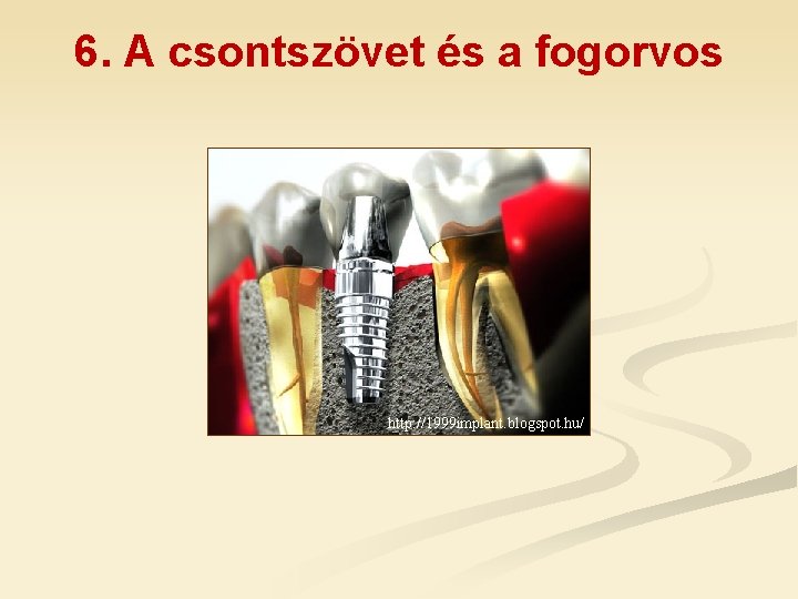 6. A csontszövet és a fogorvos http: //1999 implant. blogspot. hu/ 