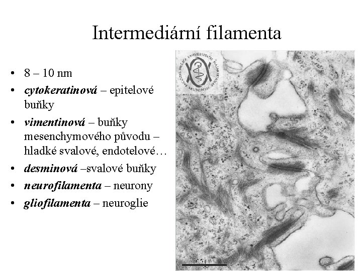 Intermediární filamenta • 8 – 10 nm • cytokeratinová – epitelové buňky • vimentinová