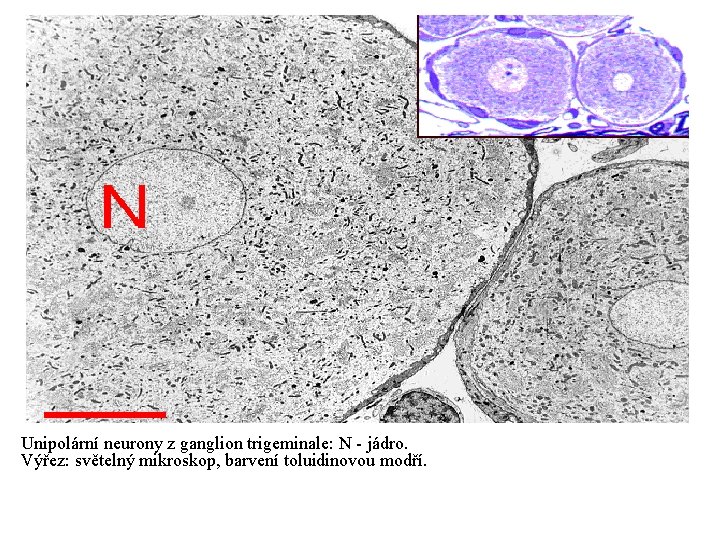  Unipolární neurony z ganglion trigeminale: N - jádro. Výřez: světelný mikroskop, barvení toluidinovou