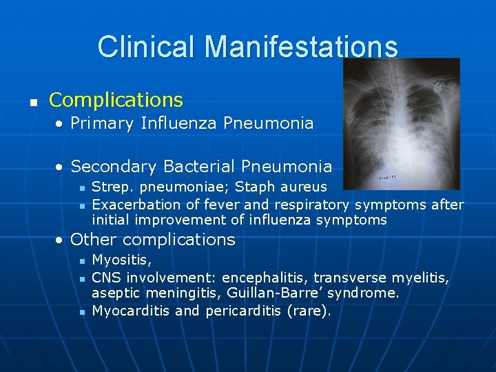 Clinical Manifestations n Complications • Primary Influenza Pneumonia • Secondary Bacterial Pneumonia n n