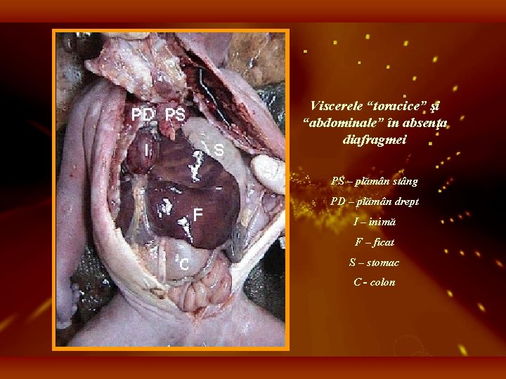 Viscerele “toracice” şi “abdominale” în absenţa diafragmei PS – plămân stâng PD – plămân