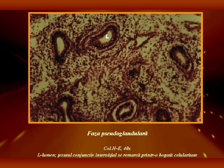 Faza pseudoglandulară Col. H-E, 40 x L-lumen; ţesutul conjunctiv interstiţial se remarcă printr-o bogată