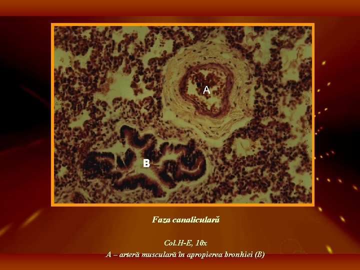 Faza canaliculară Col. H-E, 10 x A – arteră musculară în apropierea bronhiei (B)