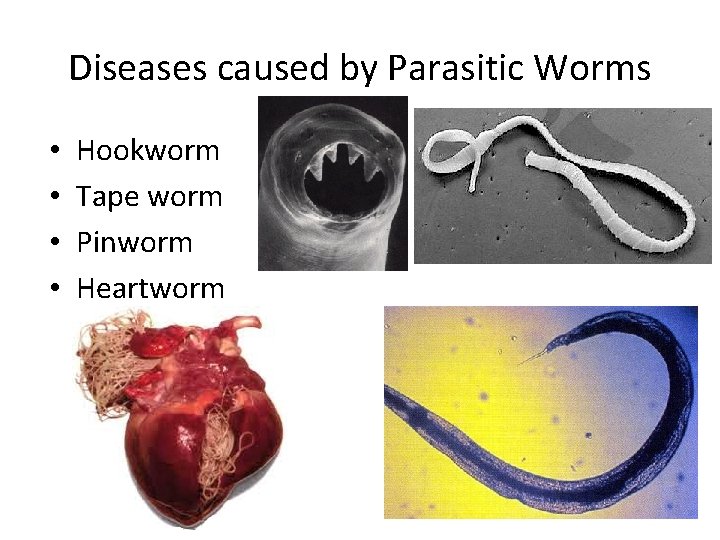 Diseases caused by Parasitic Worms • • Hookworm Tape worm Pinworm Heartworm 