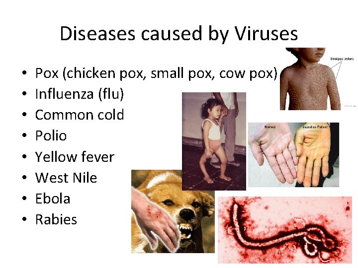 Diseases caused by Viruses • • Pox (chicken pox, small pox, cow pox) Influenza