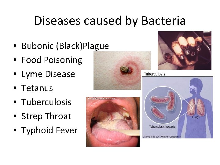 Diseases caused by Bacteria • • Bubonic (Black)Plague Food Poisoning Lyme Disease Tetanus Tuberculosis