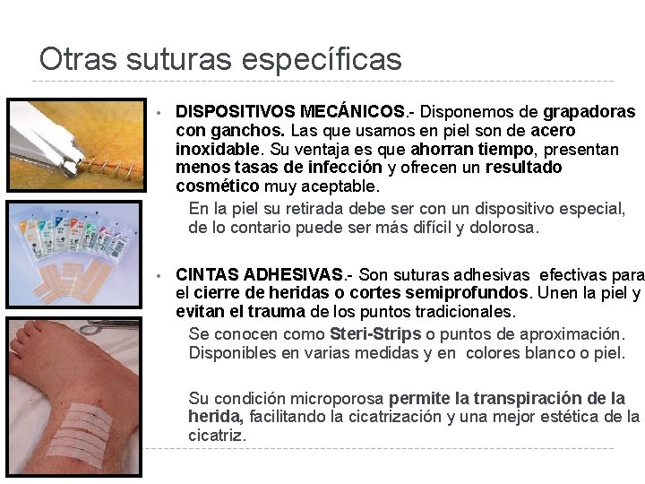 Otras suturas específicas • DISPOSITIVOS MECÁNICOS. - Disponemos de grapadoras con ganchos. Las que