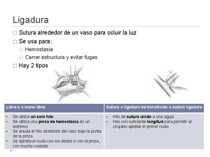 Ligadura Sutura alrededor de un vaso para ocluir la luz � Se usa para: