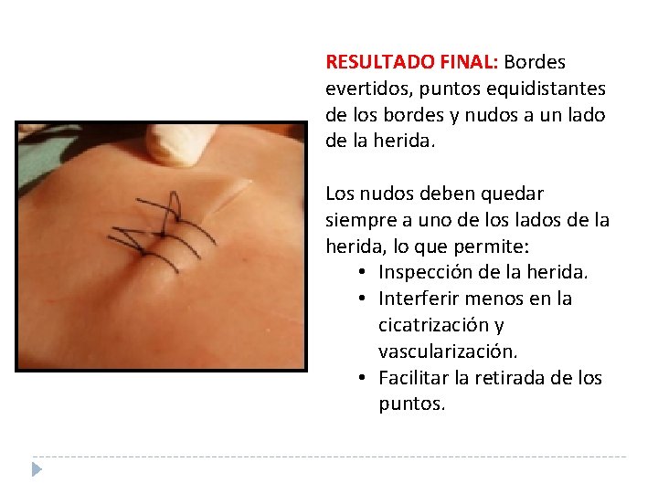 RESULTADO FINAL: Bordes evertidos, puntos equidistantes de los bordes y nudos a un lado