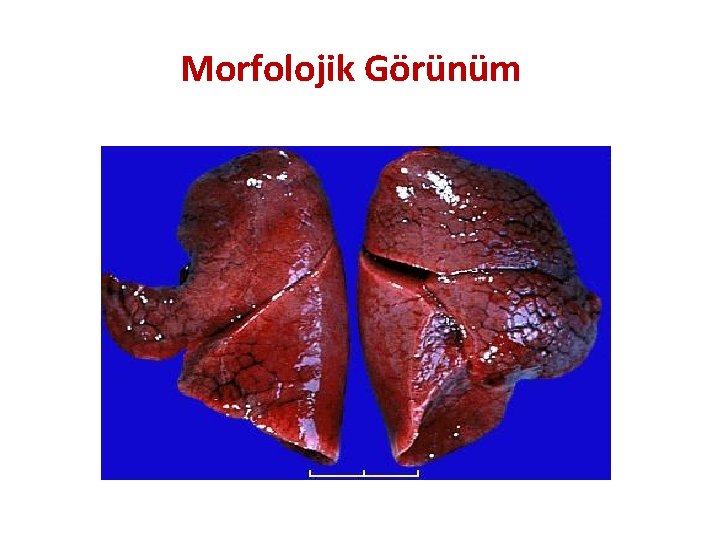 Morfolojik Görünüm 