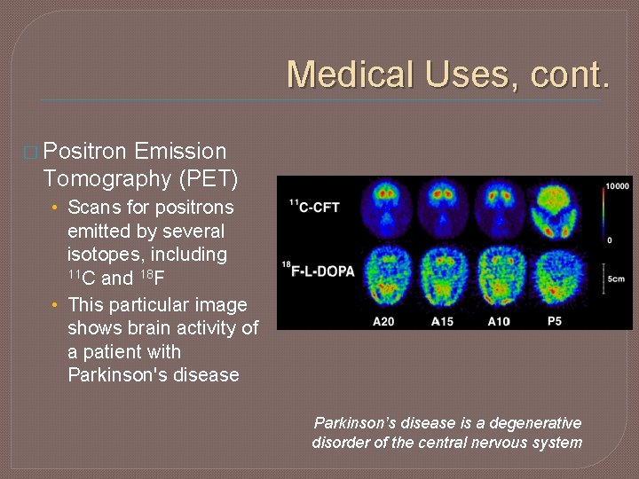 Medical Uses, cont. � Positron Emission Tomography (PET) • Scans for positrons emitted by