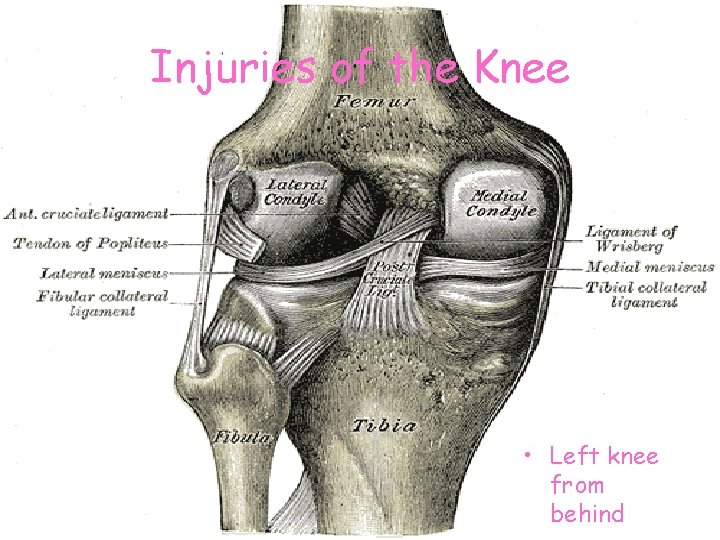 Injuries of the Knee • Left knee from behind 