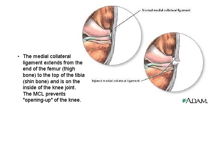  • The medial collateral ligament extends from the end of the femur (thigh
