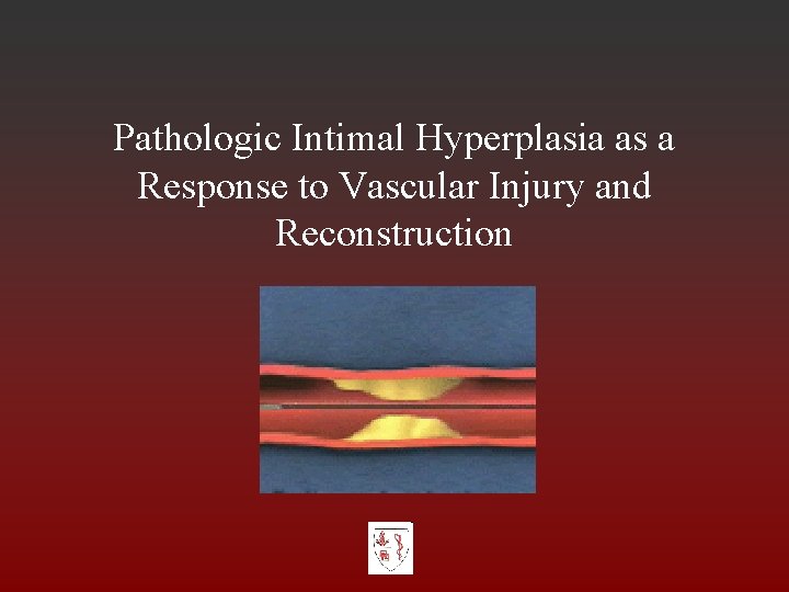 Pathologic Intimal Hyperplasia as a Response to Vascular Injury and Reconstruction 