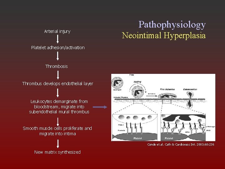 Arterial injury Pathophysiology Neointimal Hyperplasia Platelet adhesion/activation Thrombosis Thrombus develops endothelial layer Leukocytes demarginate