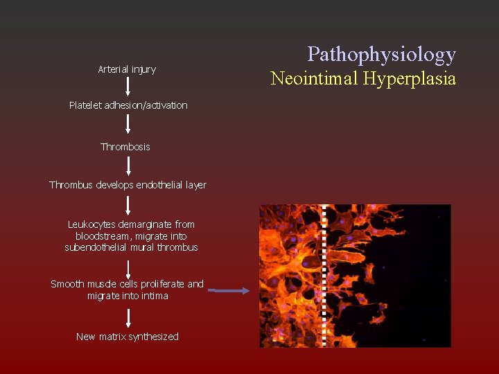 Arterial injury Platelet adhesion/activation Thrombosis Thrombus develops endothelial layer Leukocytes demarginate from bloodstream, migrate